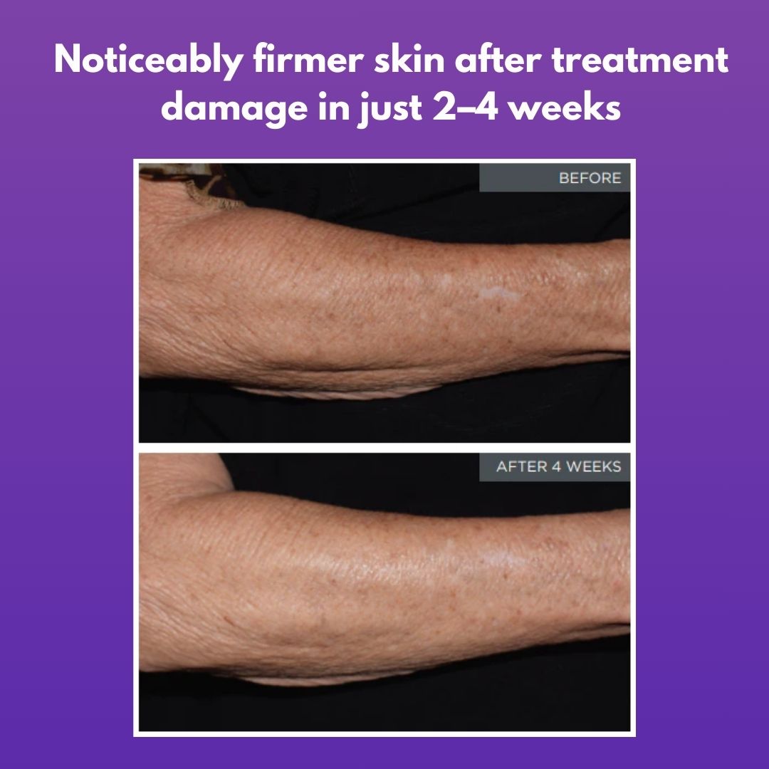 Vitae Charm Body Oil for Diabetes Warrior